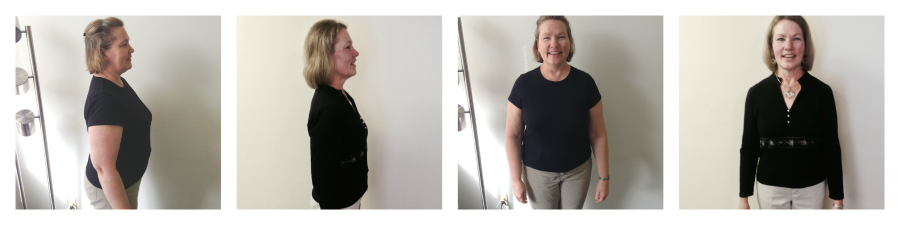Sharon R Before and After Ideal Doctors Weight Loss